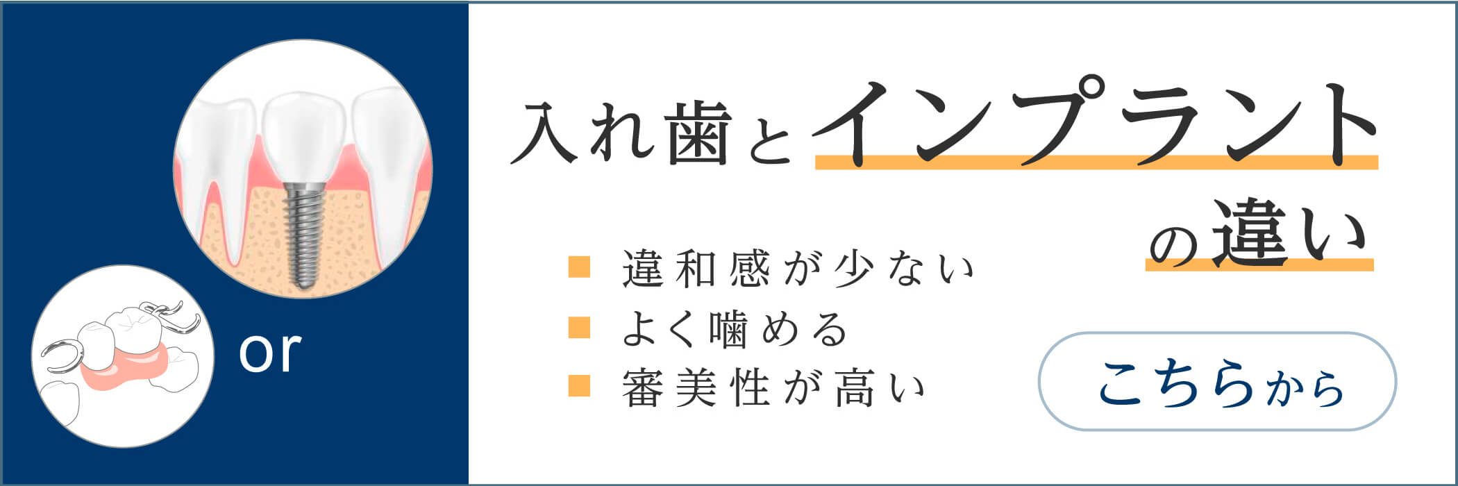 入れ歯とインプラントの違い