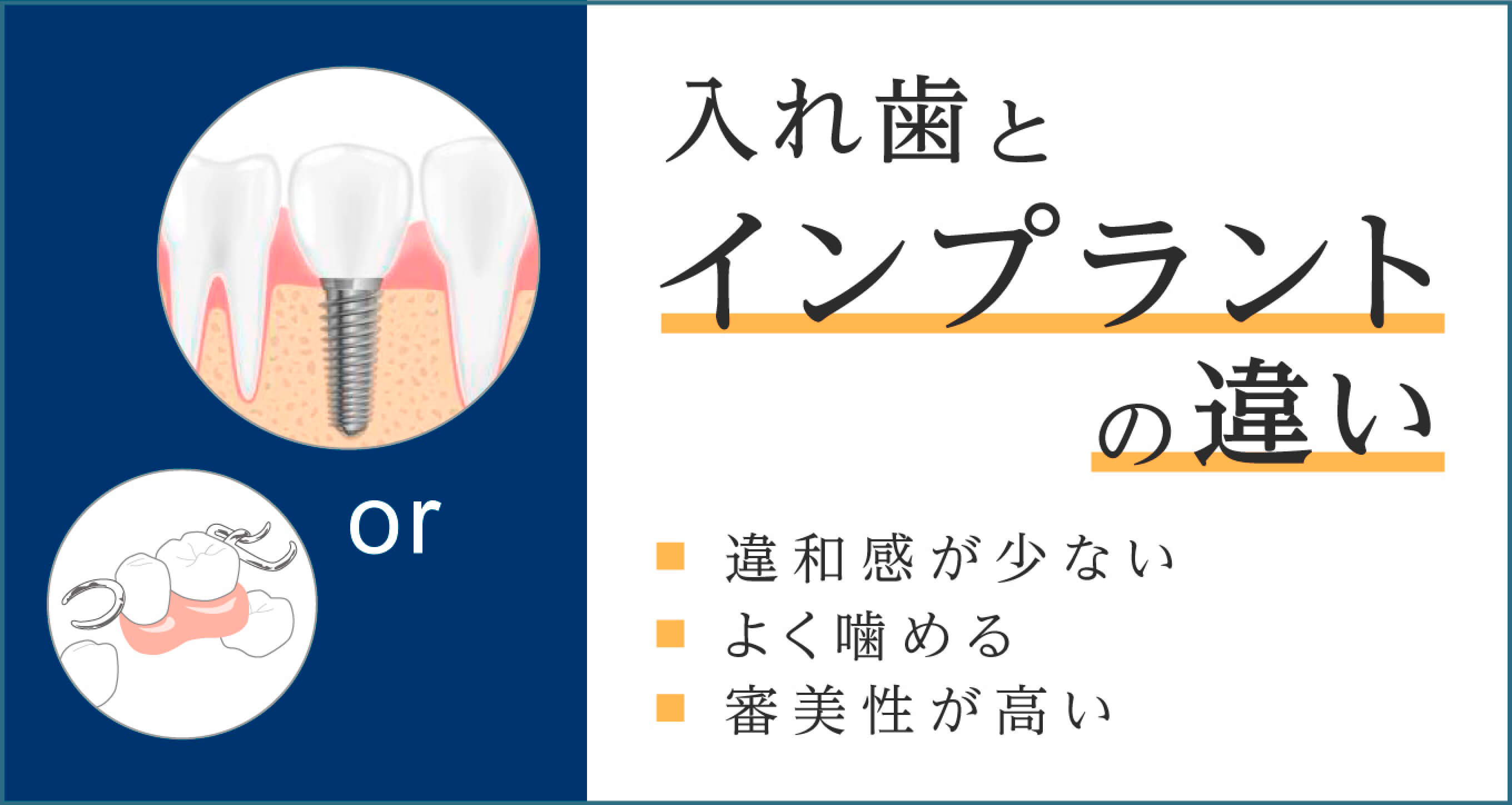 入れ歯とインプラントの違い